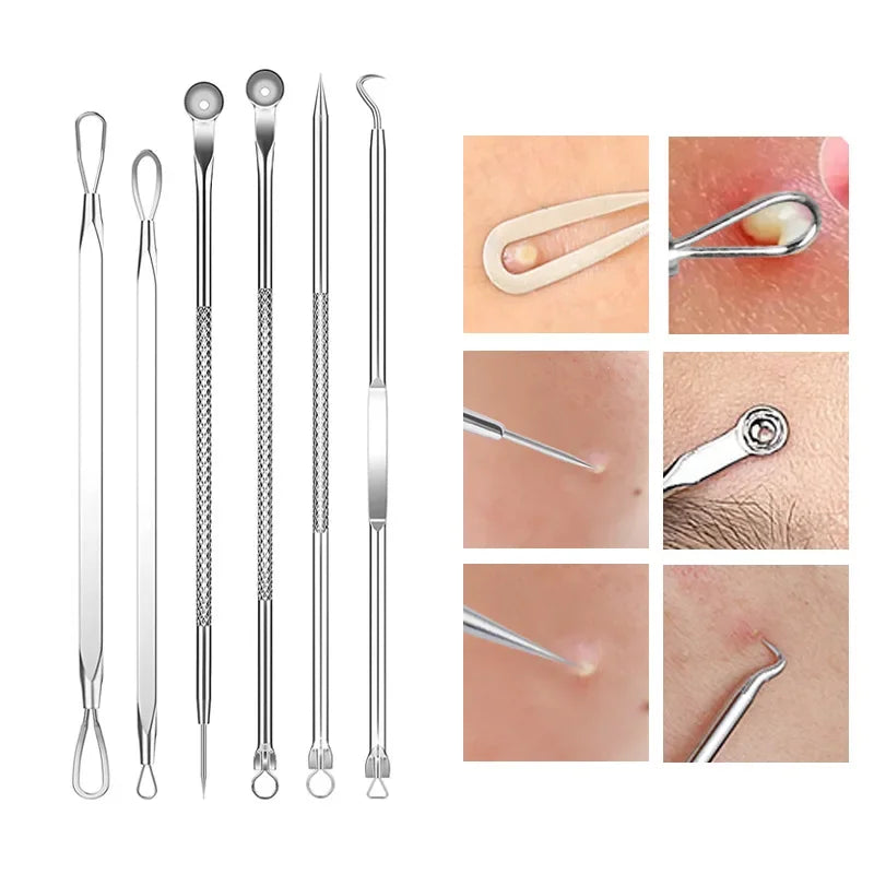 4-11Pcs Ingrown Hair Tweezers Acne Blackhead Removal Needles Black Dots Cleaner Deep Cleansing Pore Cleaner Face Skin Care Tools