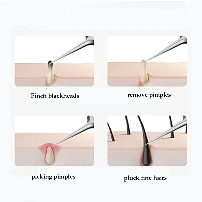 4-11Pcs Ingrown Hair Tweezers Acne Blackhead Removal Needles Black Dots Cleaner Deep Cleansing Pore Cleaner Face Skin Care Tools
