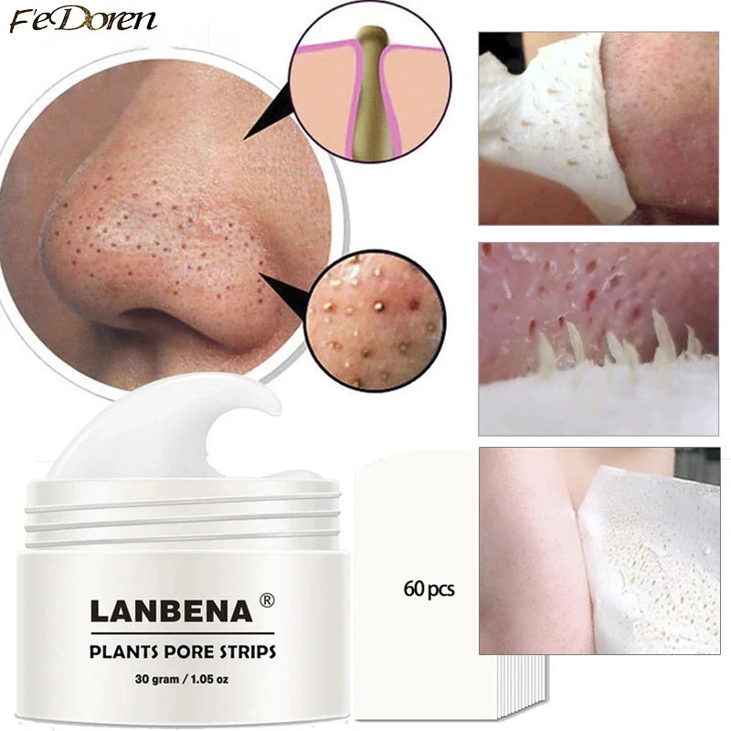 LANBENA Blackhead Remover Nasal Membrane Nose Strip Cleaner Pores Peeling Deep Cleansing Blackhead Acne Skin Care Product